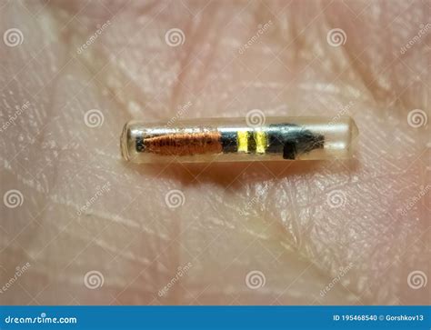 subcutaneous rfid chip|rfid microchip erythema.